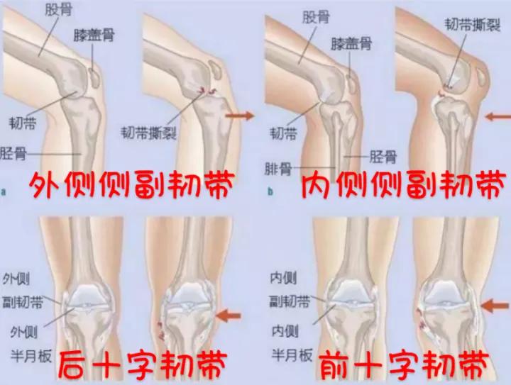 爱运动的人怎么保养膝盖,运动后保护膝盖的动作