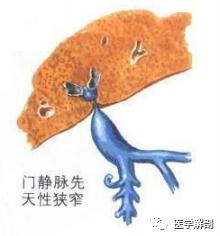 门静脉的解剖位置,门静脉的解剖及病理生理