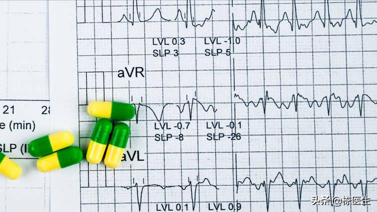 治心悸心慌的中医药方,心慌心悸中医怎么辨证