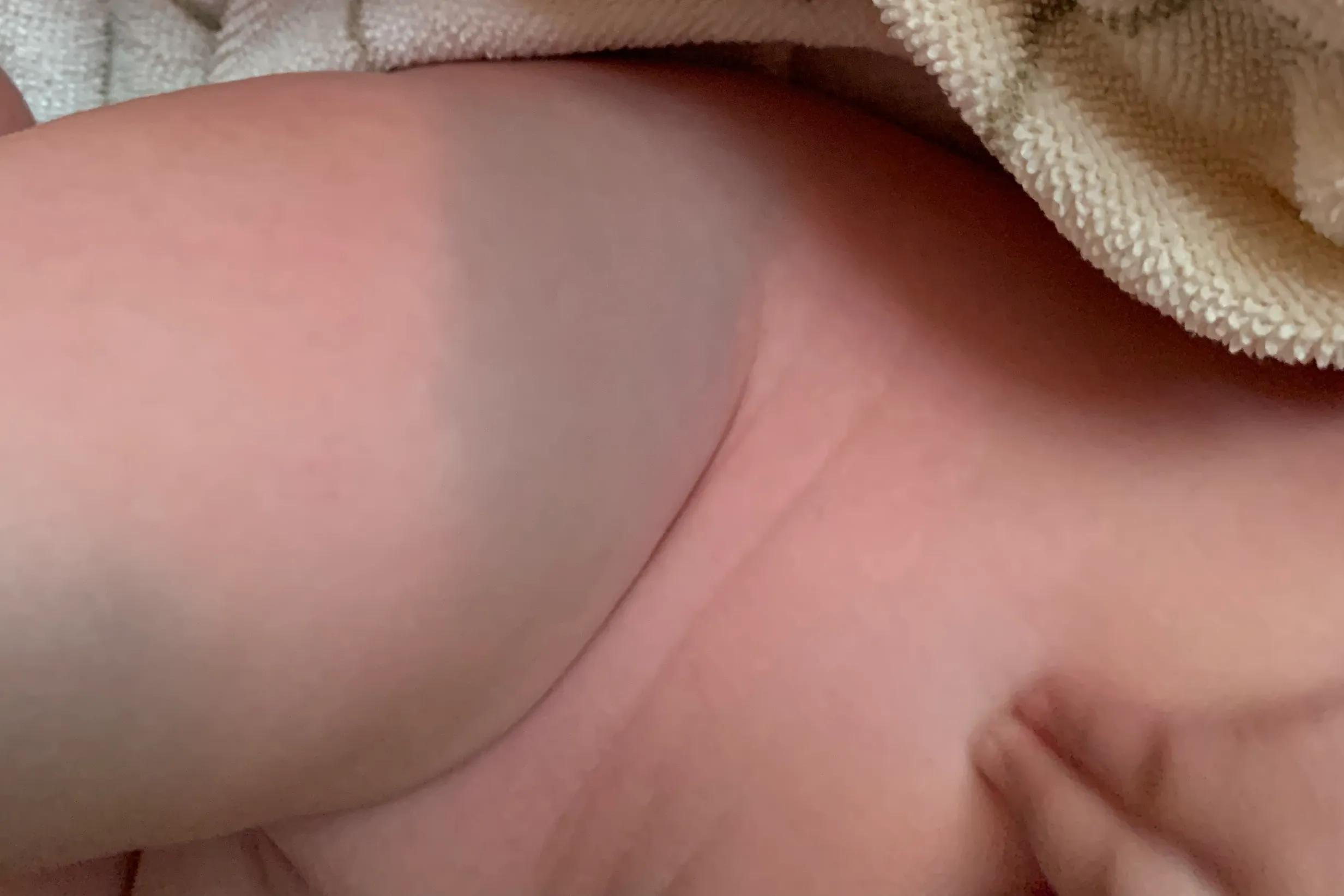 我家宝宝手上有胎记,宝宝身上有个胎记模糊不清