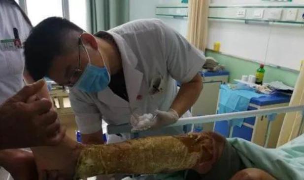 河南男子掉入油锅后来怎么样了,河南男子掉进油锅