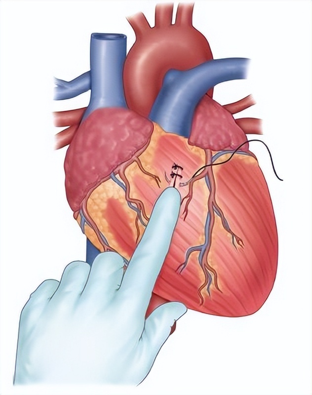 经典重印《急诊医学技术操作流程图解》急诊必备宝典