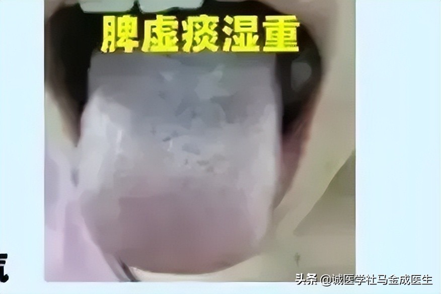 5岁小孩脾胃差吃什么中成药调理,脾胃肝肾肺亏损全部调理的中成药