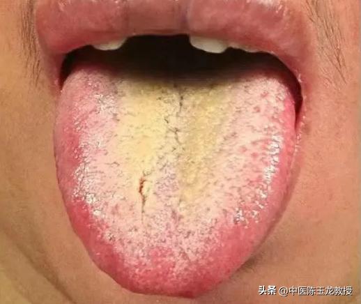 阴囊潮湿能力下降？送你一方清热燥湿，赶走潮热，还你健康本色