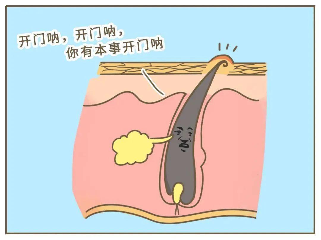 鸡皮肤怎么打理好看,鸡皮肤严重怎么遮