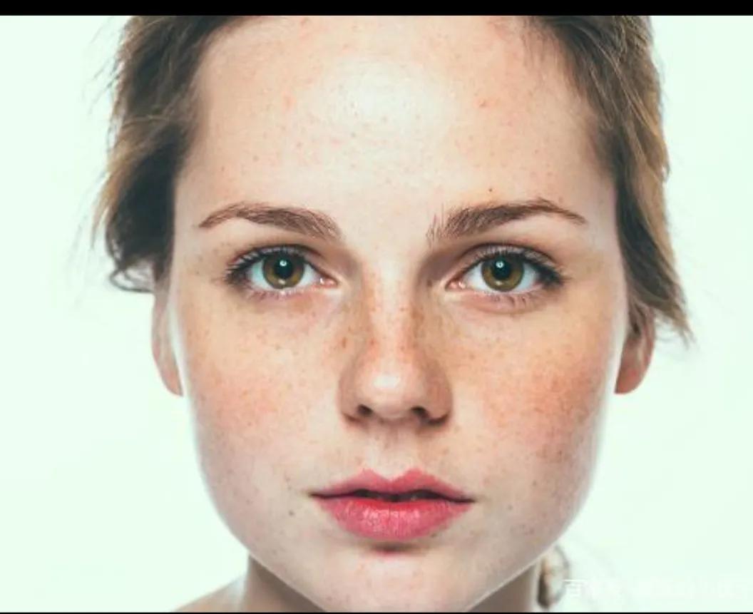 40多岁脸上长黑点是什么斑,40岁脸上长斑用什么护肤品