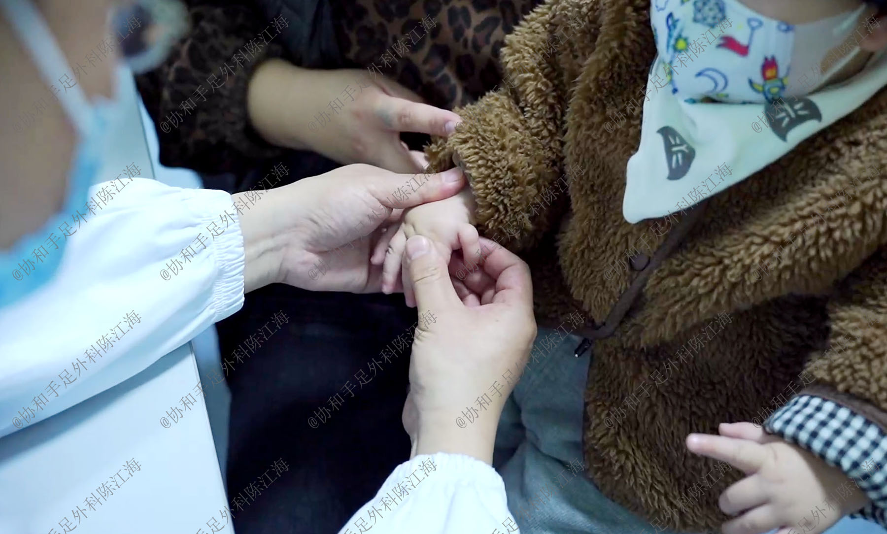 漂浮趾的治疗,拇指漂浮指的治疗方案