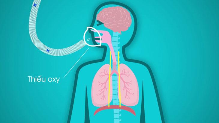 慢阻肺患者如何使用制氧机,慢阻肺医用多少升制氧机好