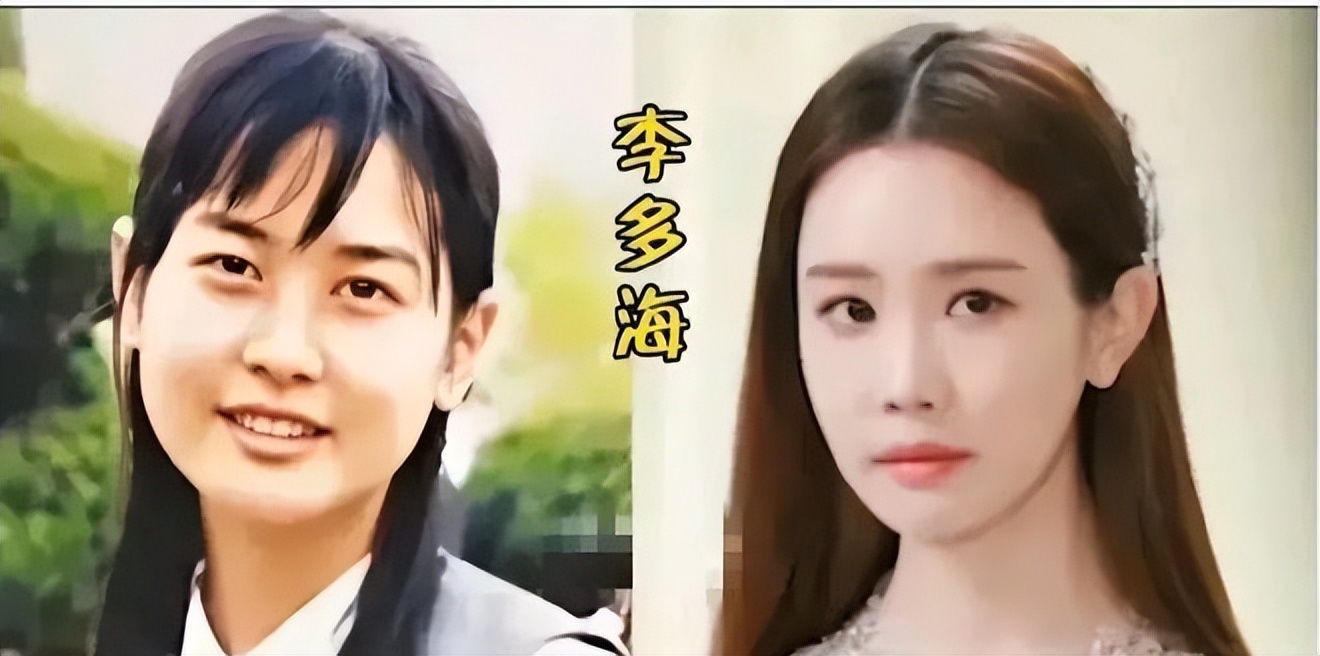 中国明星韩国整容对比,韩国明星整容变毁容