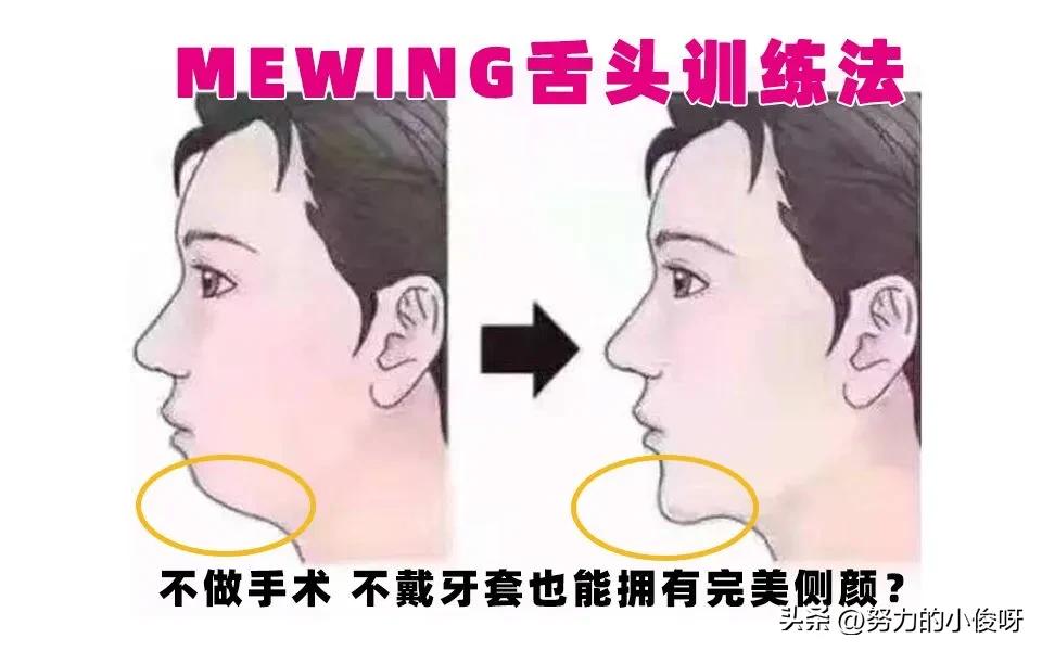 嘴凸怎么改善最有效果,23岁改变口呼吸可以改善嘴凸吗