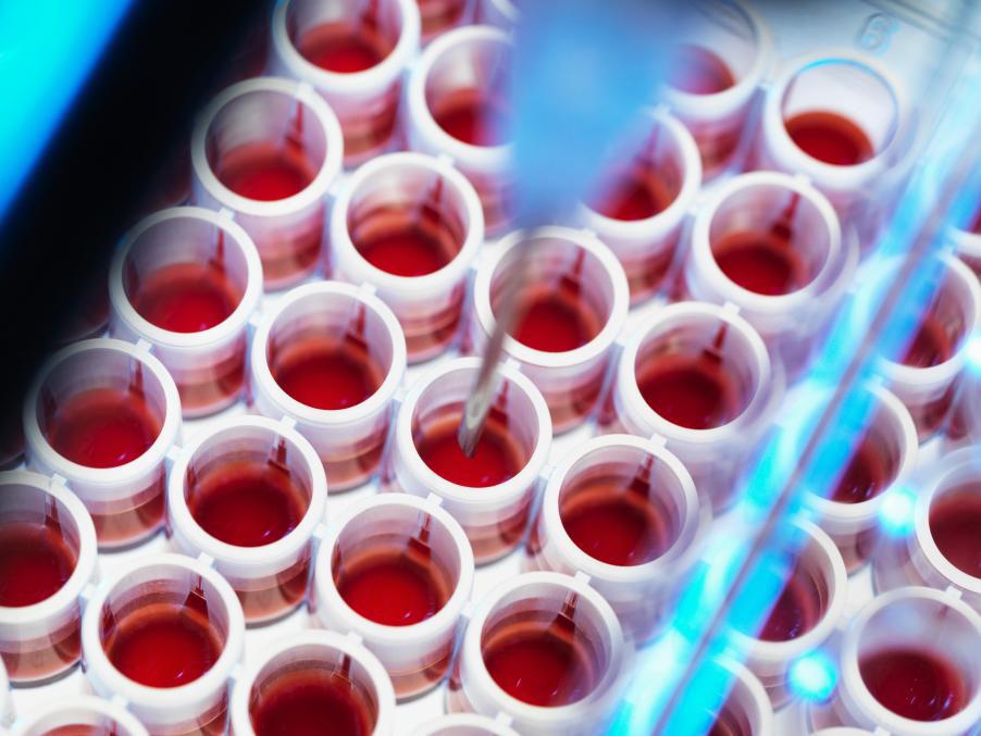 血hcg什么意思,血液hCG什么意思