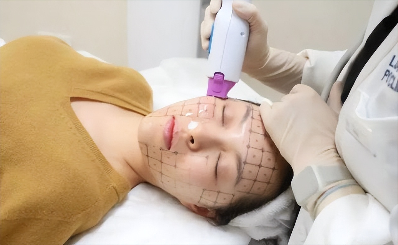 热玛吉从什么时候开始流行的,热玛吉适合哪种肌肤