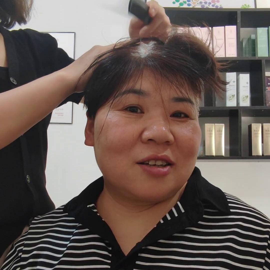 白头发看皮肤科吗,看白头发