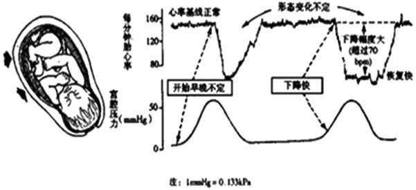 孕妈妈需要经历什么,从怀孕到生需要做多少次产检