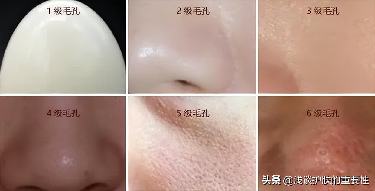 脸上的毛孔粗大用什么护肤品好,脸部毛孔粗大用什么护肤品比较好