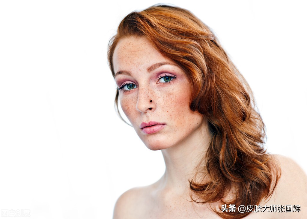 色斑严重怎么调理淡化色斑,怎么样分别表皮色斑还是真皮色斑