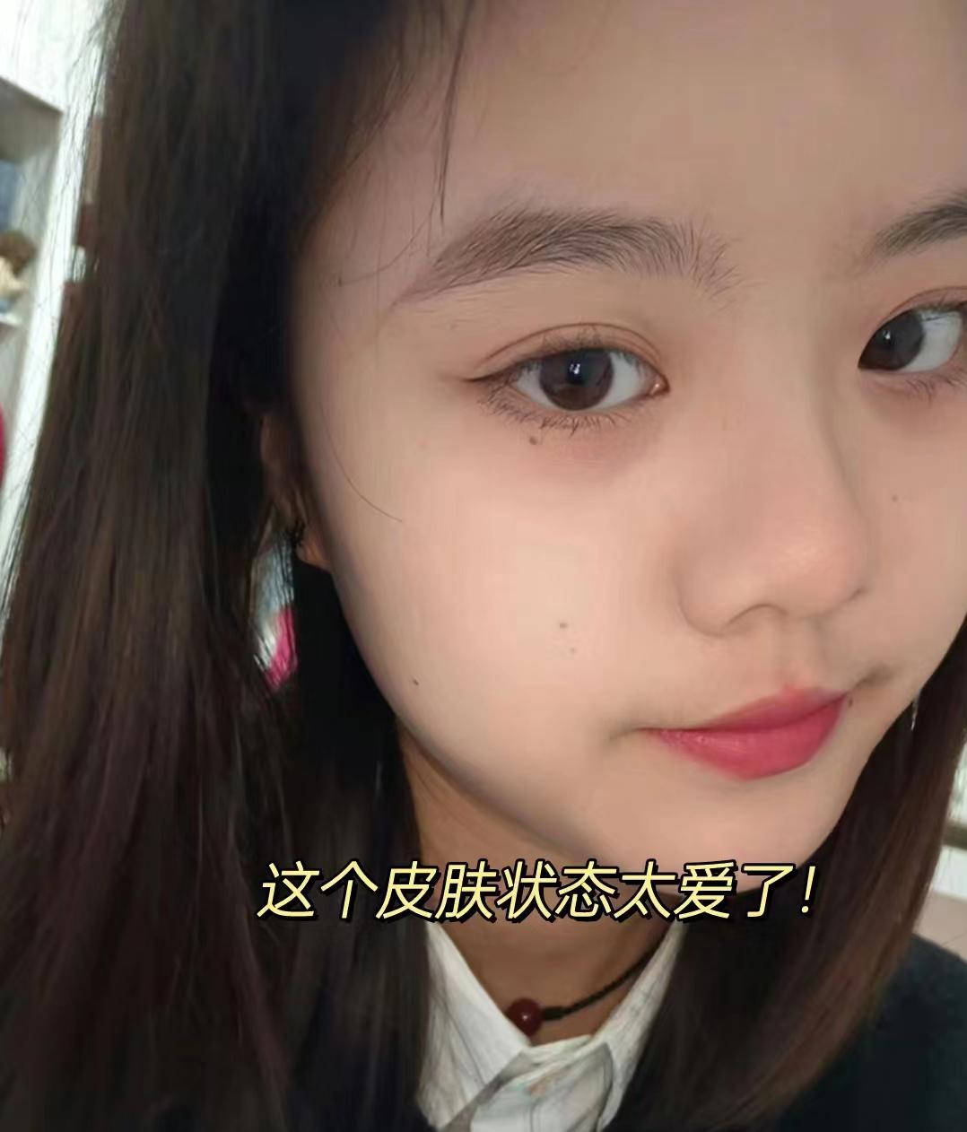 最全祛痘精华大测评,祛痘产品测评推荐