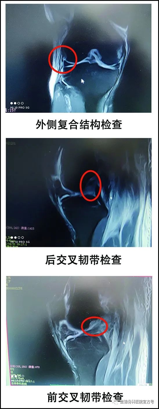 盘锦骨科医院治疗成功案例,盘锦骨科医院扩建