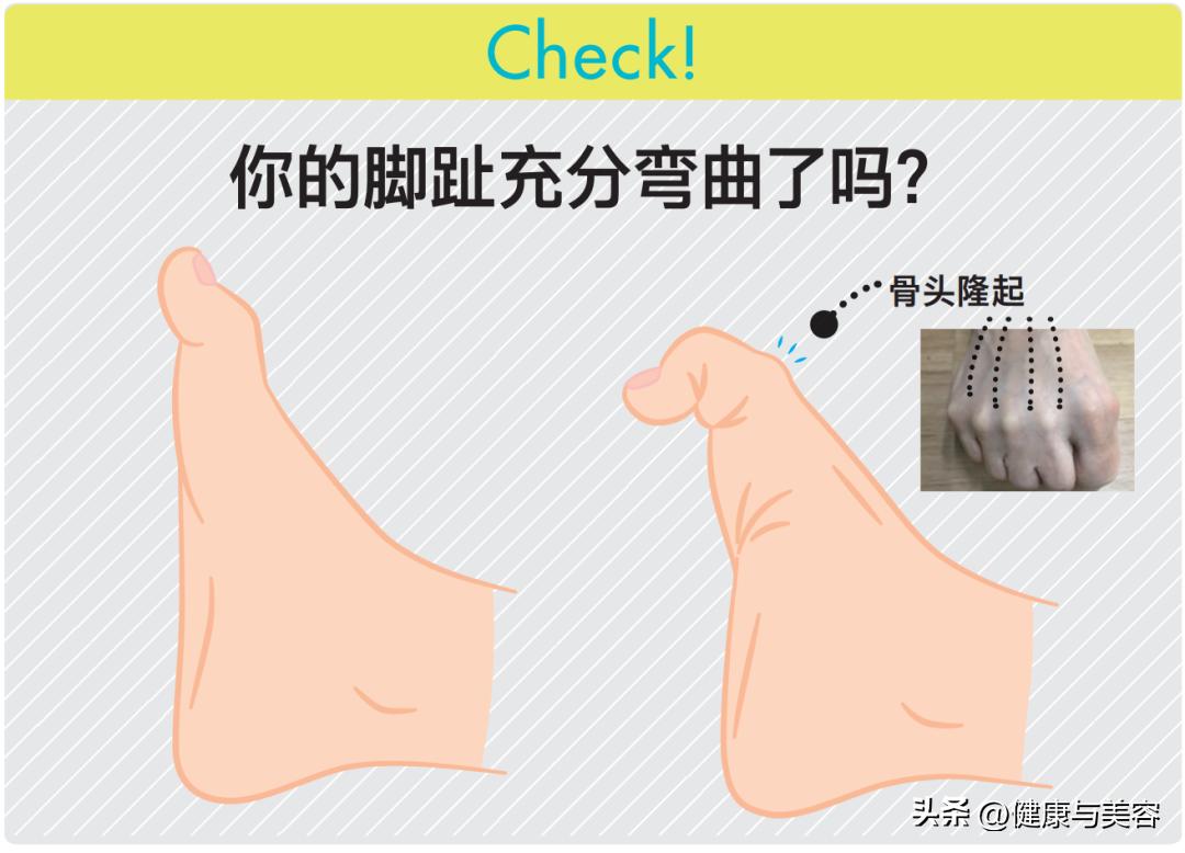 指甲卷曲内卷,指甲卷曲用什么药