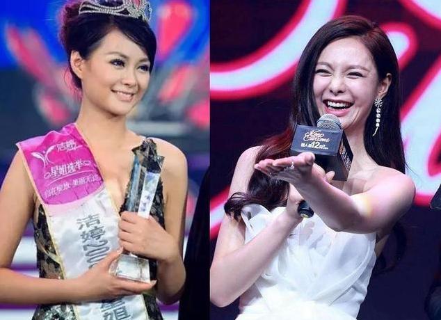 盘点整容失败惨不忍睹的30位女星,那些整容整失败的女明星