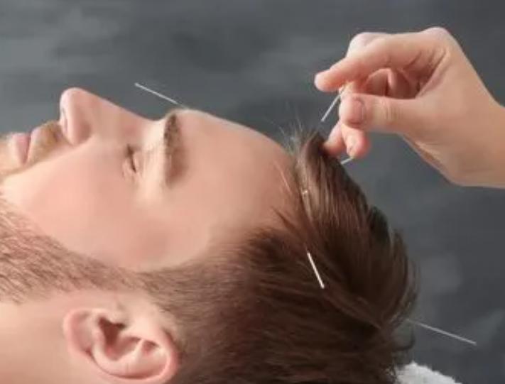 医学科普过敏性鼻炎,中国变应性鼻炎诊断和治疗指南