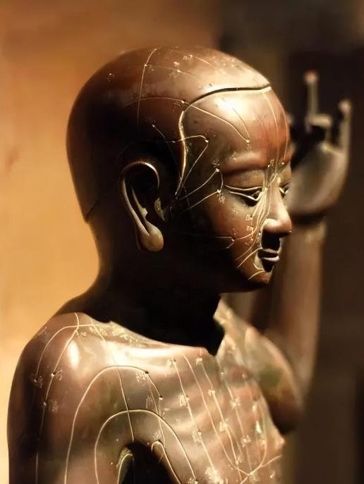 日本针灸铜人,日本古代铜人针灸