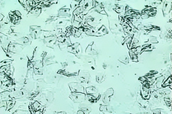 派特灵治妇科病吗,派特灵在妇科怎么使用