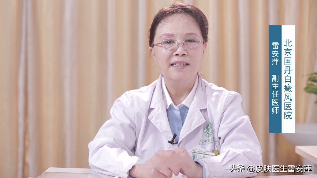 晕痣型白癜风怎么治疗,晕痣型白癜风治疗方法