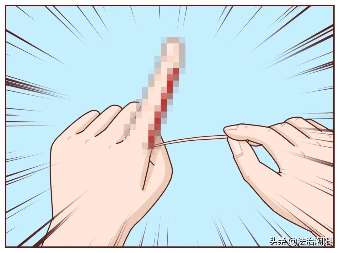 手指长倒刺缺乏哪种维生素,宝宝手指倒刺是缺什么维生素