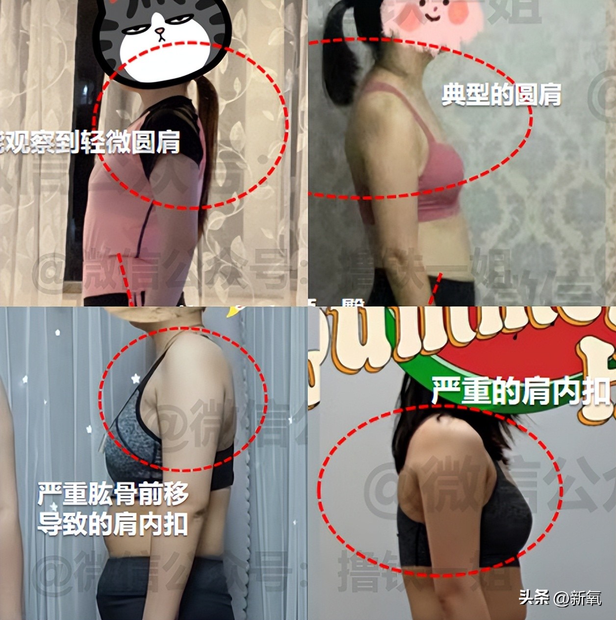 圆脸女明星拍照为什么没有双下巴,女明星圆肩对比