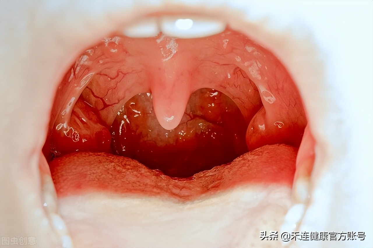 9项让人闻风丧胆的医学检查，其实是这么做的