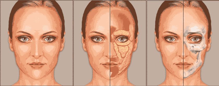 皮肤松弛法令纹深怎么改善面部,皮肤松弛法令纹怎么消除学生