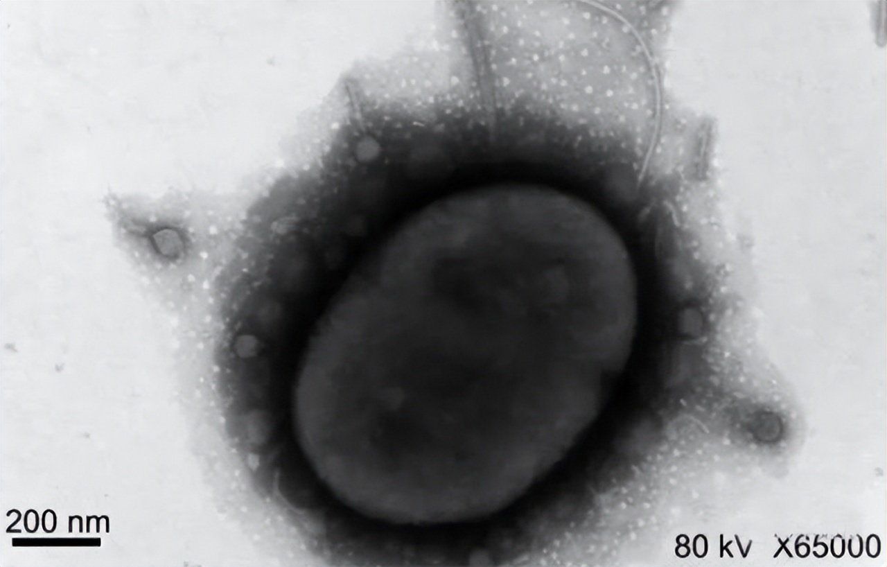 绝处逢生！女科学家用边缘疗法救绝症丈夫，9个月改写人类抗菌史