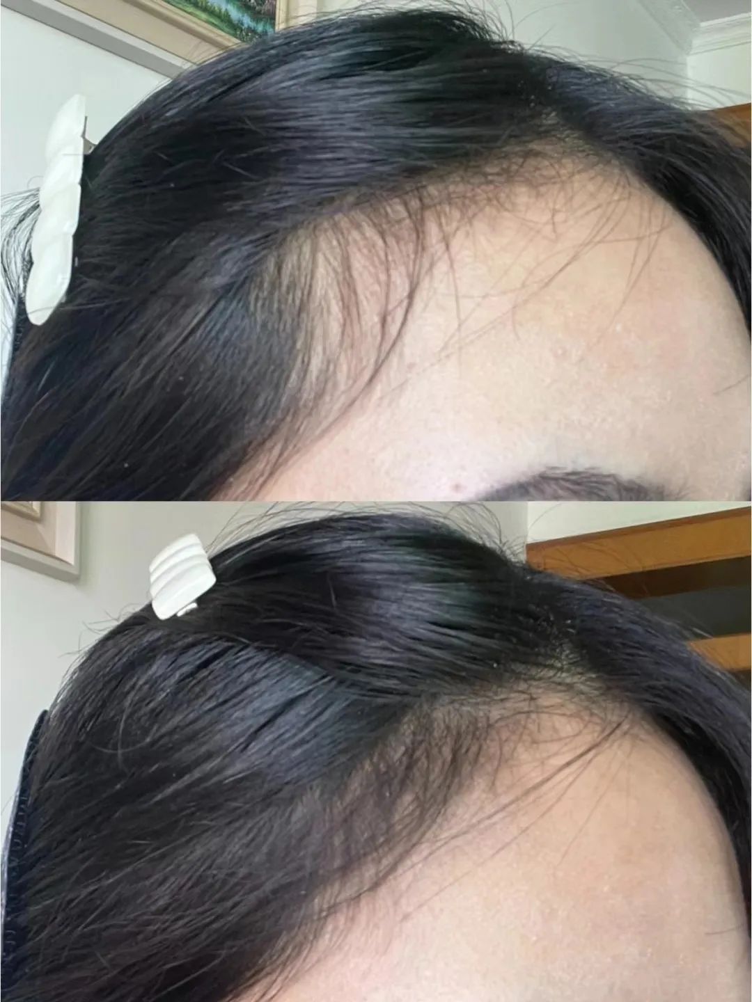 杨超越整了容吗,杨超越变了一个样子吗