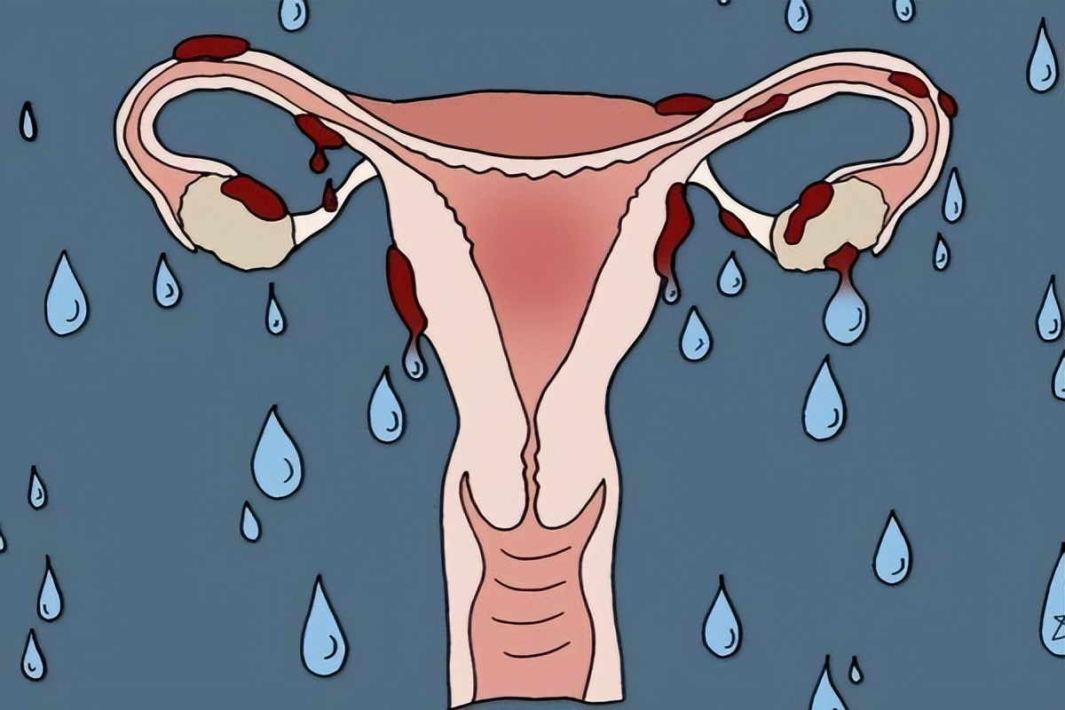 绝经不一定是坏事！妇科主任：绝经后，三个健康问题或悄悄退出