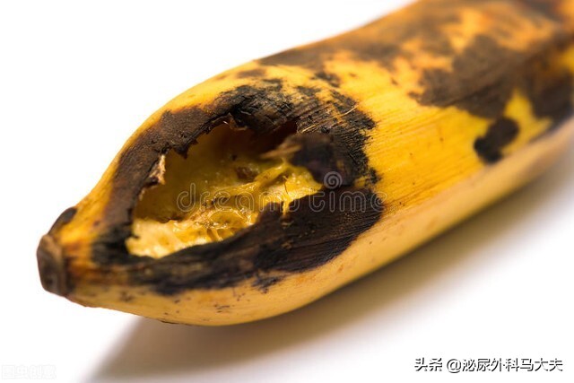 包皮过长用包皮阻复环有用吗,假性包皮戴阻复环有效吗