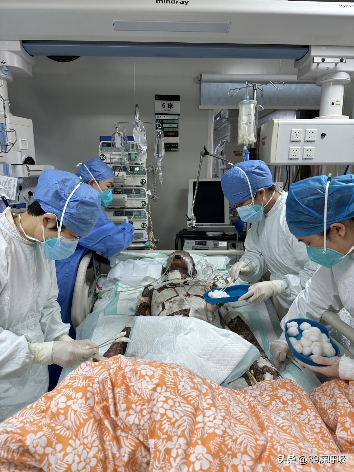 成年男反复湿疹体重瘦了12斤,14岁男孩身上95%都溃烂了