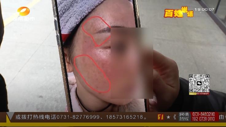 298元祛斑花了几千能祛成功吗,298祛斑套餐