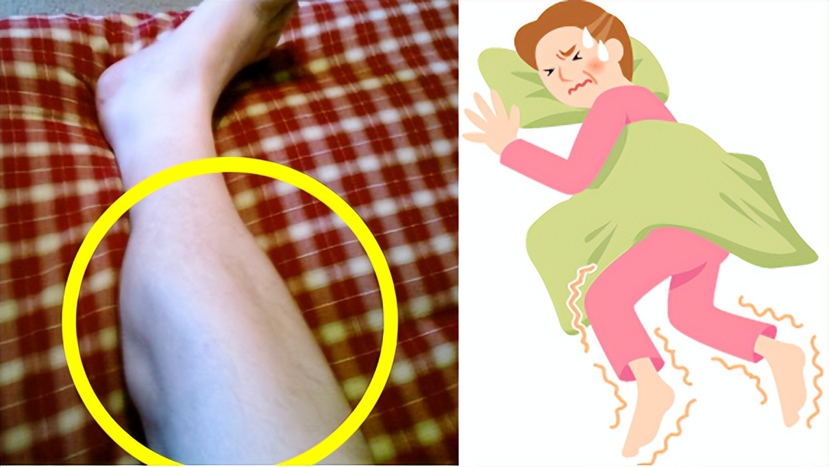 睡觉突然腿抽筋并非缺钙,睡觉腿抽筋缺钙是怎么回事