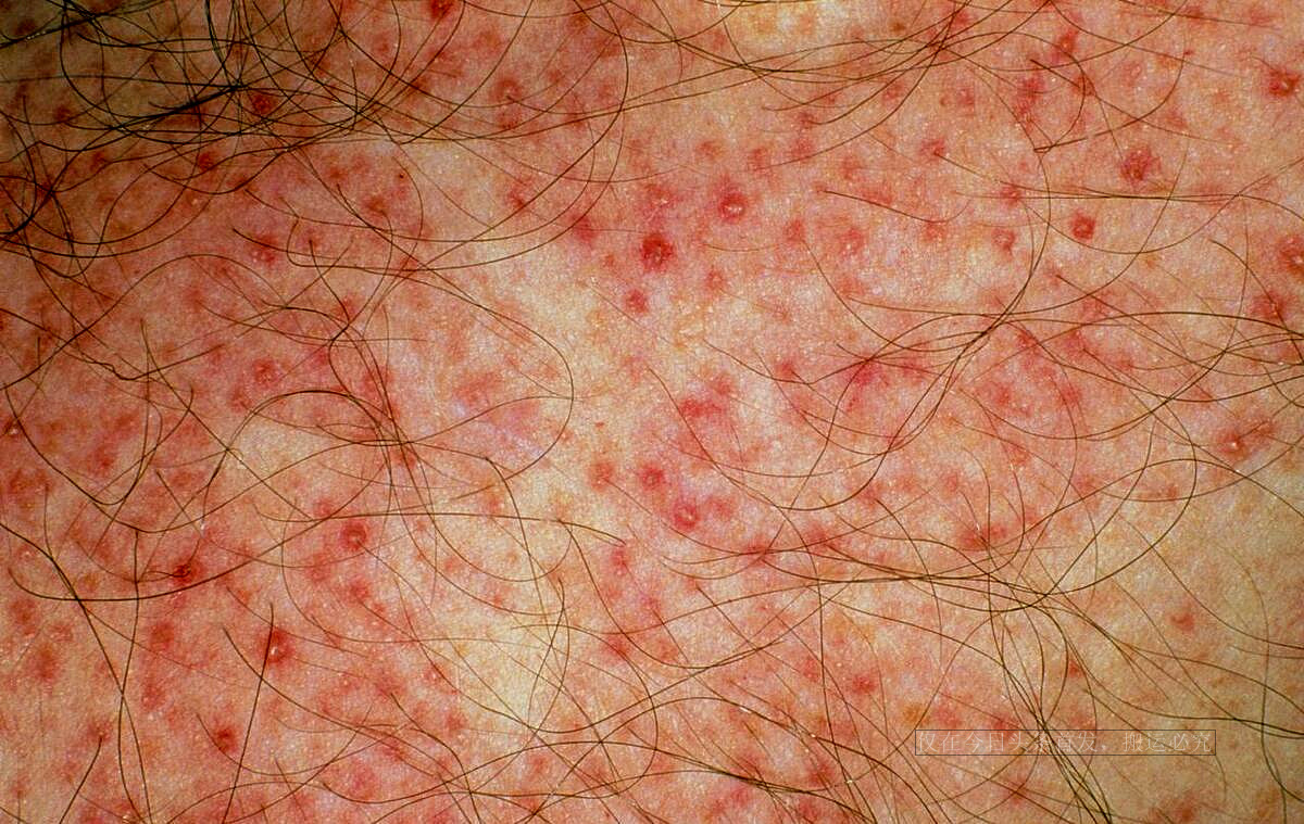 气死，我跟男友相亲认识，他讨厌我*处私**毛发，晚上偷偷把我的剃了