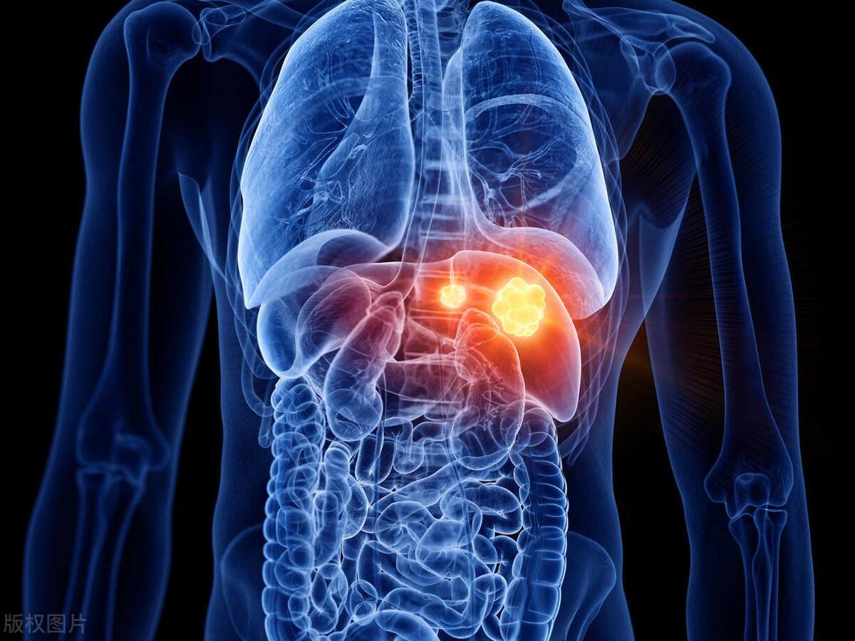 三种牙膏或暗藏致癌风险,牙膏危害有哪几种