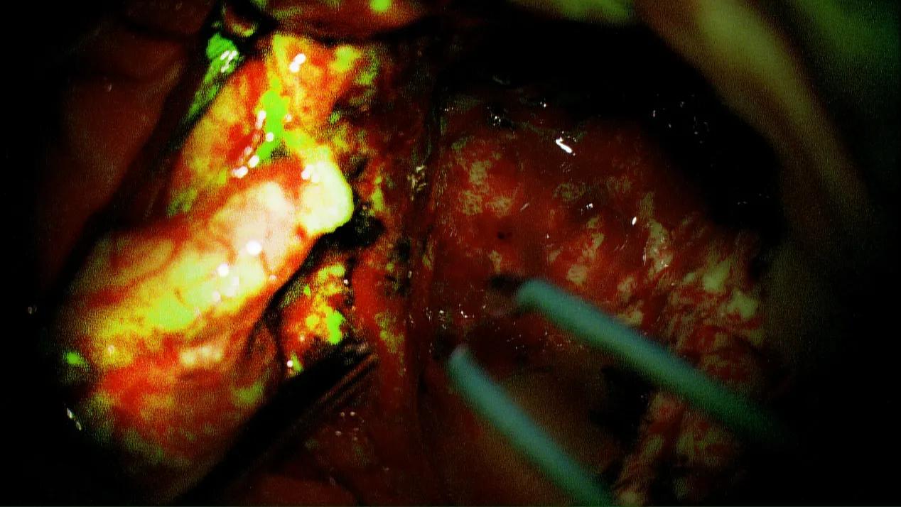 广西南溪山医院视频,广西南溪山医院新院区