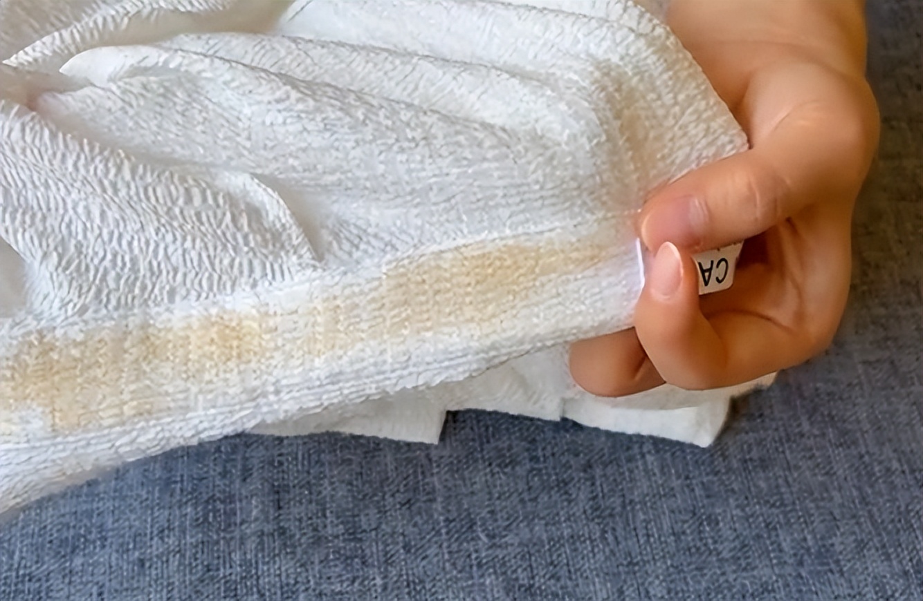 白衣服黄了怎么洗都洗不掉,白衣服有霉点怎么洗下来