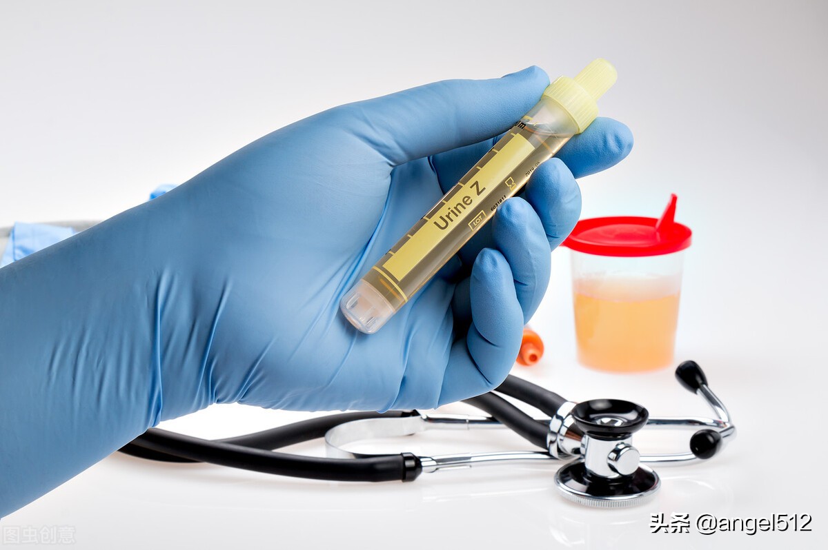 尿袋有沉淀物该怎么做,尿袋怎么收集尿液