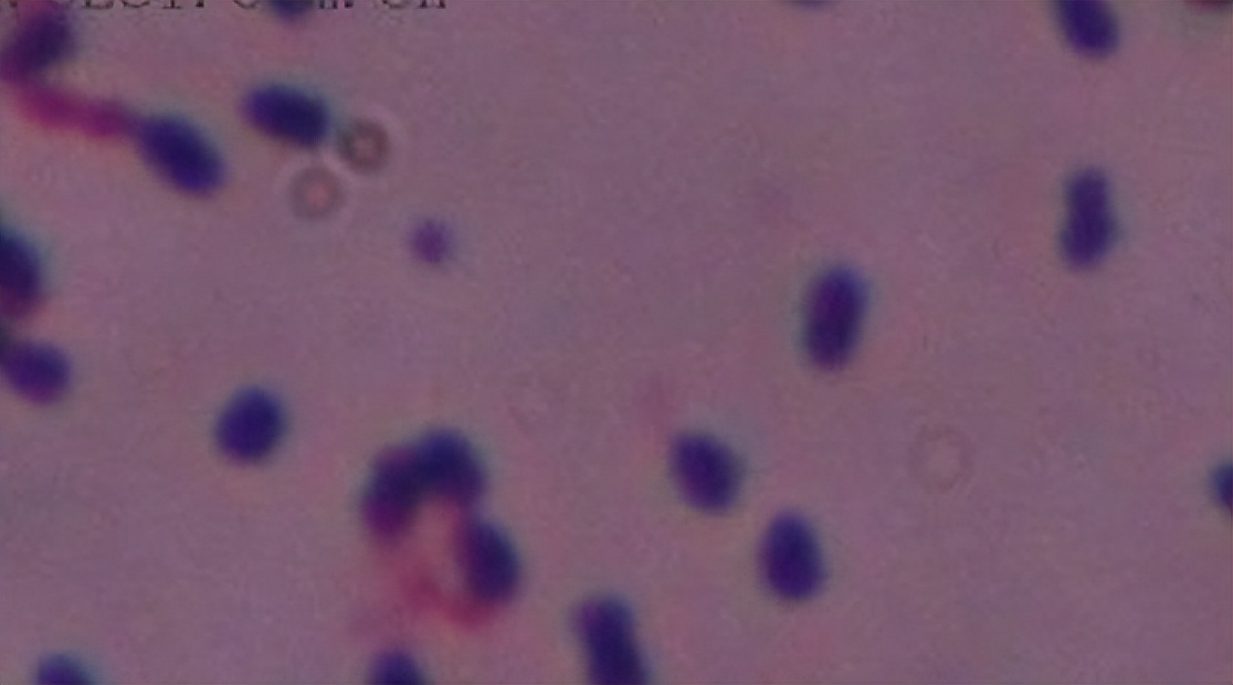 世界上最致命的病毒九种,细菌和病毒哪个更致命