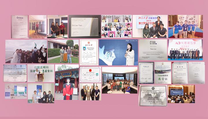 隐适美牙套脸型变化,戴隐适美牙套