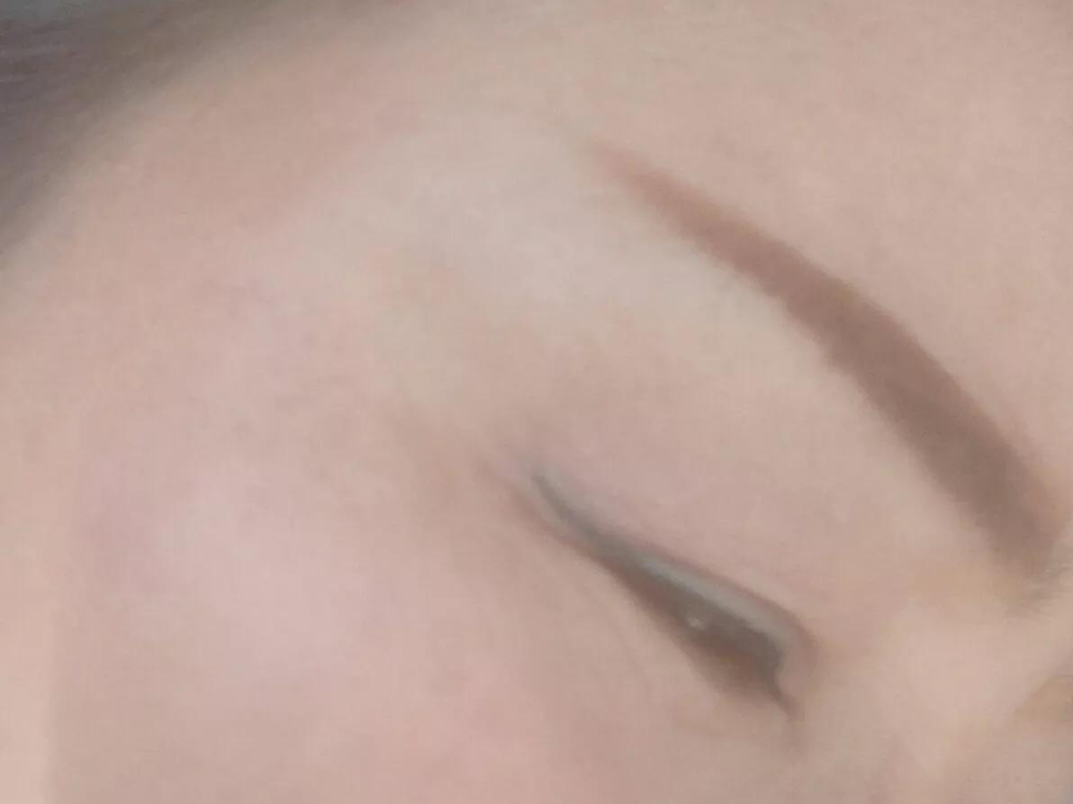 药水点斑有没有点好的呢,药水点斑的亲身经历