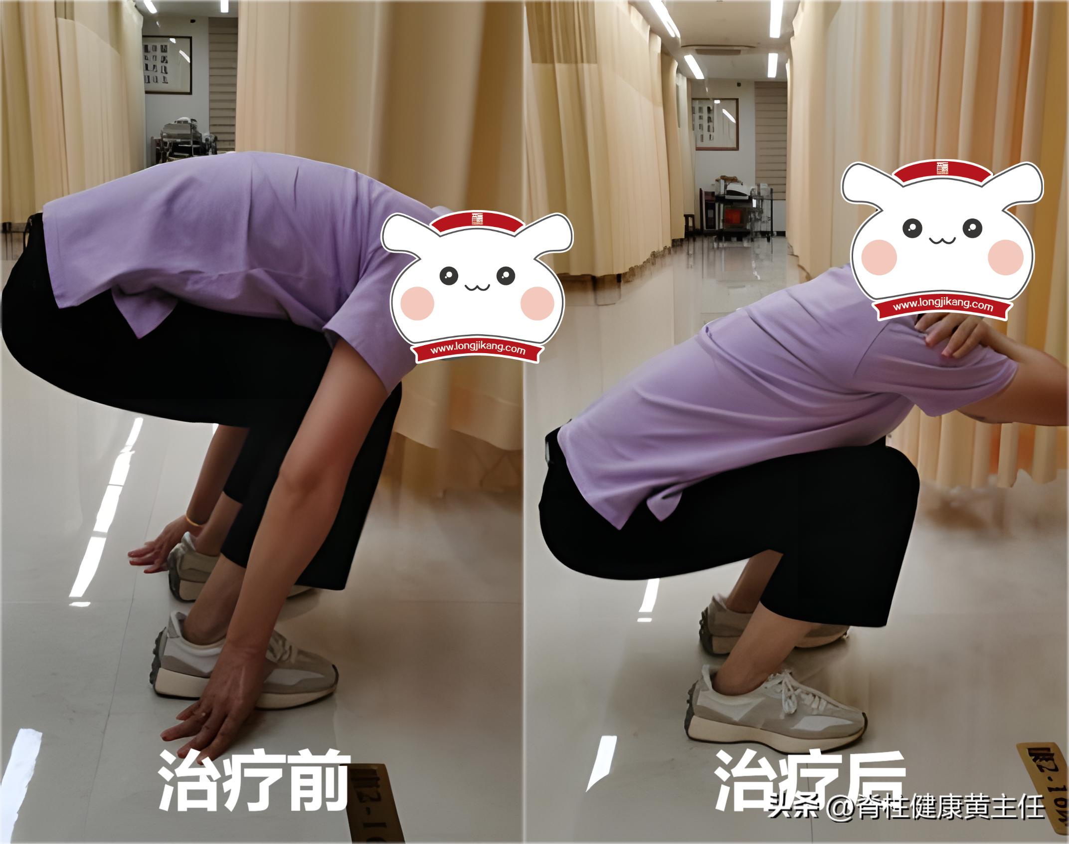 下蹲时膝盖疼痛怎么草药治疗,下蹲膝盖疼怎么治疗最好最有效