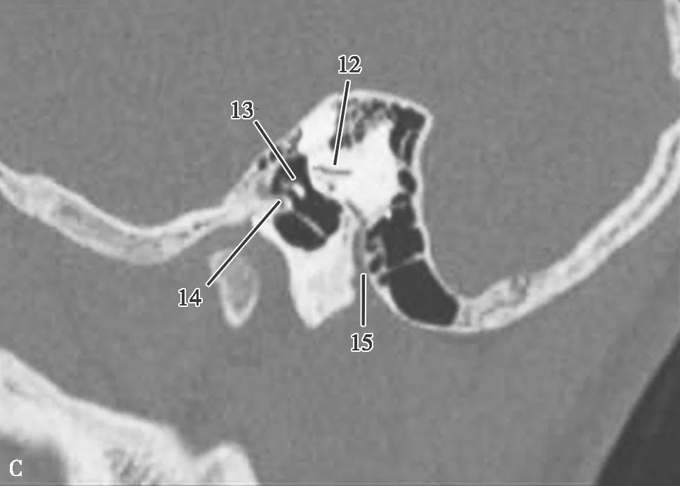 耳部解剖结构和生理功能,耳部解剖笔记