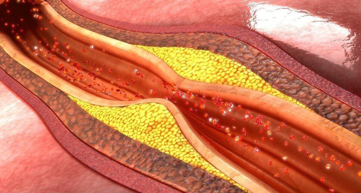 长期服用阿托伐他汀有啥危害,长期服用阿托伐他汀有何危害